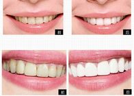 Частная система отбеливания зуба продуктов личной заботы логотипа для домашних зубов забеливая